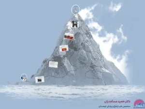 ادم ریوی در ارتفاعات