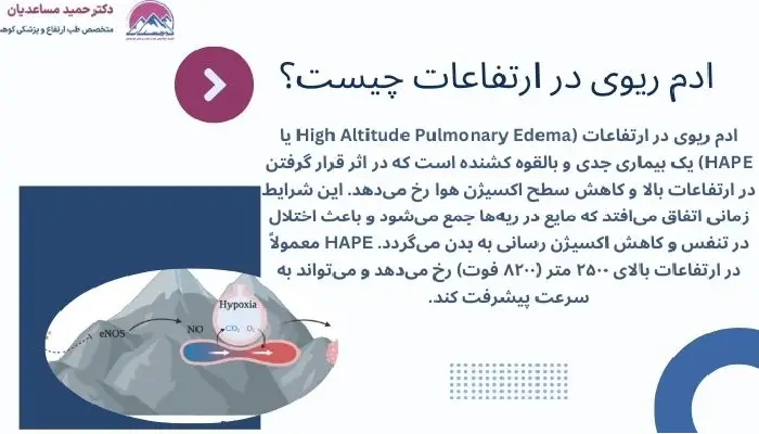 ادم ریوی در ارتفاعات