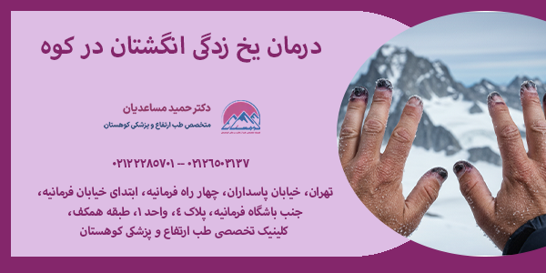 درمان یخ زدگی انگشتان در کوه