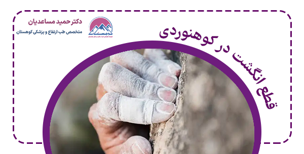 چیست قطع انگشت در کوهنوردی.